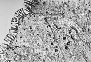 celiakia celiakia